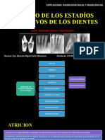 Estudio de Los Estadíos Regresivos