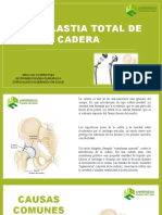 Artroplastia de Cadera