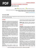 Hipergranulación en Úlceras de Miembros Inferiores: Casos Clínicos