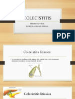 COLECISTITIS