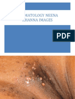 Dermatology Neena Khanna Images