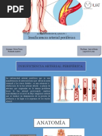 Insuficiencia Arterial