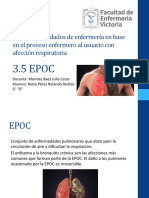 EPOC