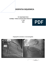 Cardiopatia Isquemica 2022