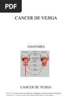 Cancer de Vejiga