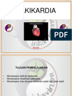 Takikardia Acls