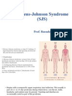 Stiven Jhonson Syndrom