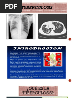 PDF Tuberculosis 2022