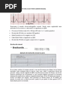 Interpretación Del Electrocardiograma