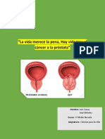 Cáncer de Próstata