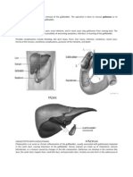 Cholecystectomy