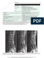 Bells Palsy Nelsons TextBook of Pediatrics 20th Edition