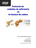 Cuidados de Enfermeria de Una Fractura Cerrada