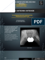 Osteoma Osteoide - Caso Clinico-Radiologico