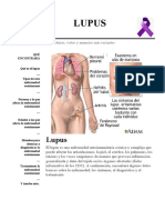 Lupus Eritematoso Sistémico