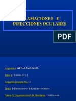 Inflamaciones e Infecciones Oculares