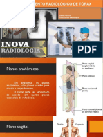 Posicionamento Vs Incidencia