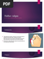 Hallux Valgus