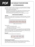 Arritmias Cardiacas