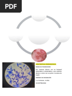 Dermatotifosis