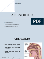 Adenoid It Is