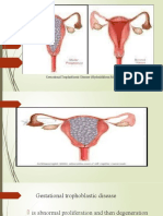 2nd Trimester Bleeding