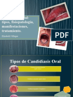 Candidiasis Oral