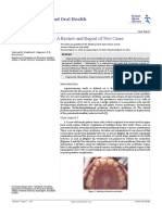 Mesiodens A Review and Report of Two Cases