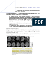 Esclerosis Multiple