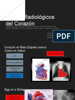 Signos Radiológicos Del Corazón