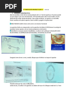 1º Twin Block