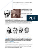 El Curioso Caso de Phineas Gage y La Barra de Metal en La Cabeza