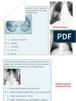 Pasitos Dpi Parcial