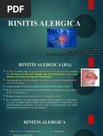 RINITIS ALERGICA Curso Enfermeria