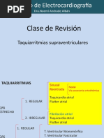 Taquiarritmias Supraventriculares