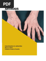 ARTROSIS