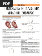 6 - Hemorragias de La Segunda Mitad Del Embarazo