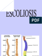 E Scoliosis