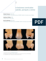 Articulo Lesiones No Cariosas