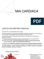 Arritmia Cardiaca