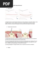 Global Posterior Approach