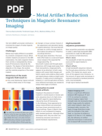 Syngo WARP Metal Artifact Reduction Techniques in MRI 1800000000284426