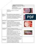 Lesiones Blancas