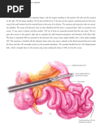 Atlas of Surgery Cameron Volume II. 2nd