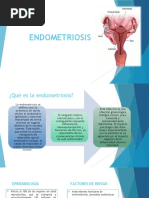 ENDOMETRIOSIS