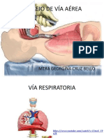 Intubacion Endotraqueal