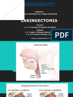 Laringectomia Técnica Quirúrgica