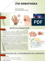 Artritis Rematoide