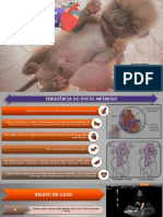 Persistencia Do Ducto Arterioso - Relato de Caso