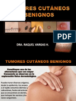 Tumores Cutáneos Benignos